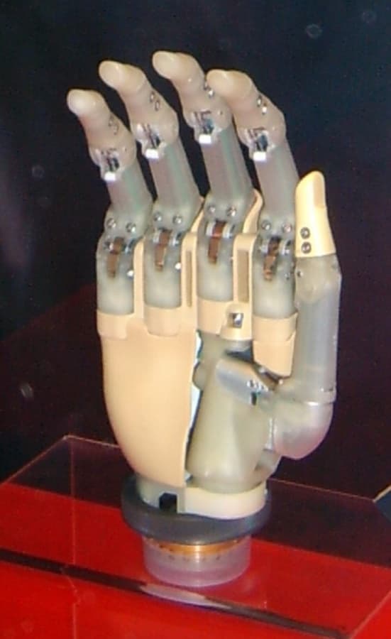 The i-LIMB, an early bionic prosthetic hand with exposed articulated fingers